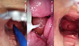 Cận Cảnh Nội Soi Lồn Em Rau Sạch Và Xuất Tình Vào Trong 3 Cận Cảnh Nội Soi Lồn