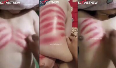 Chàng rể may mắn giúp mẹ vợ cạo gió và cái kết